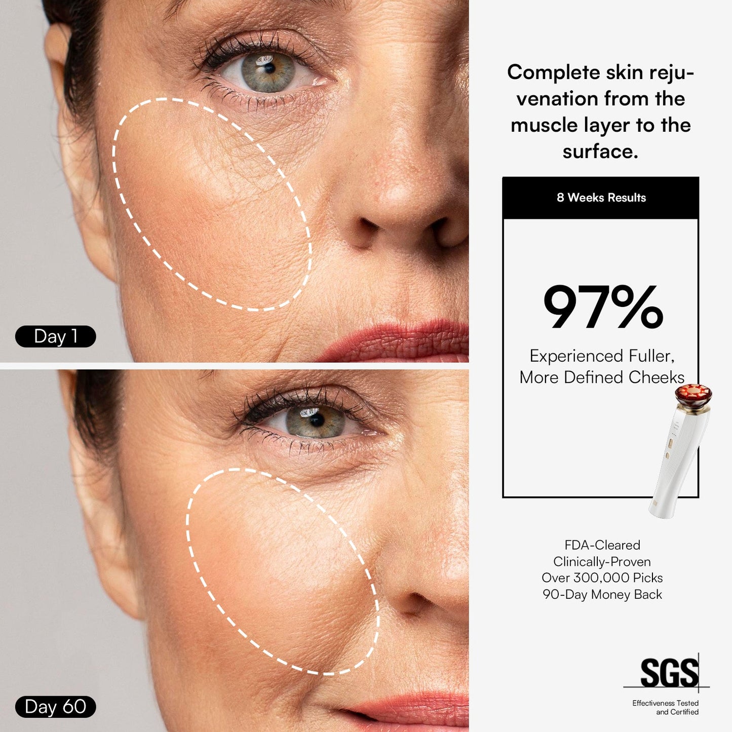 DermaCurrent Anti-Aging Therapy Wand