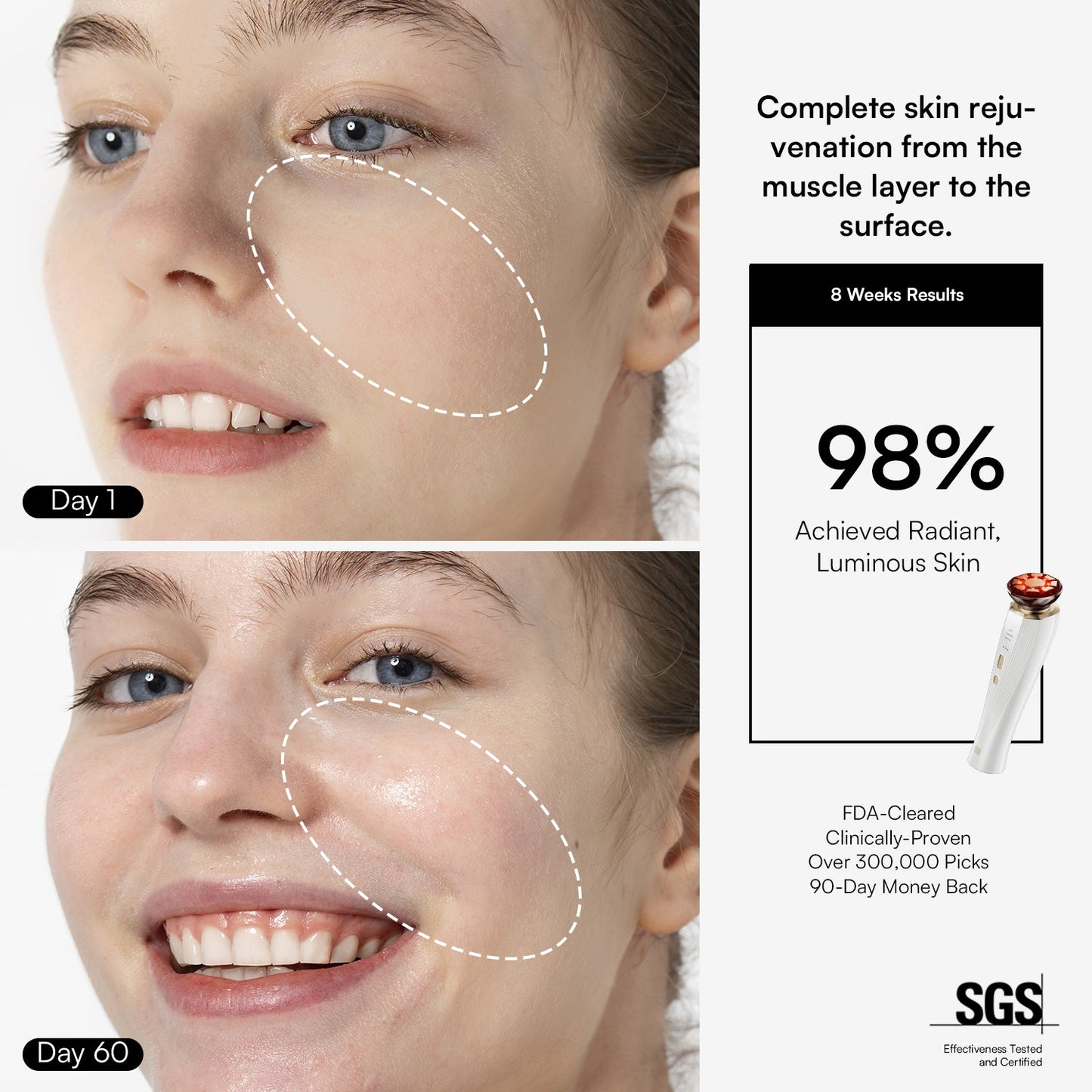 DermaCurrent Anti-Aging Therapy Wand