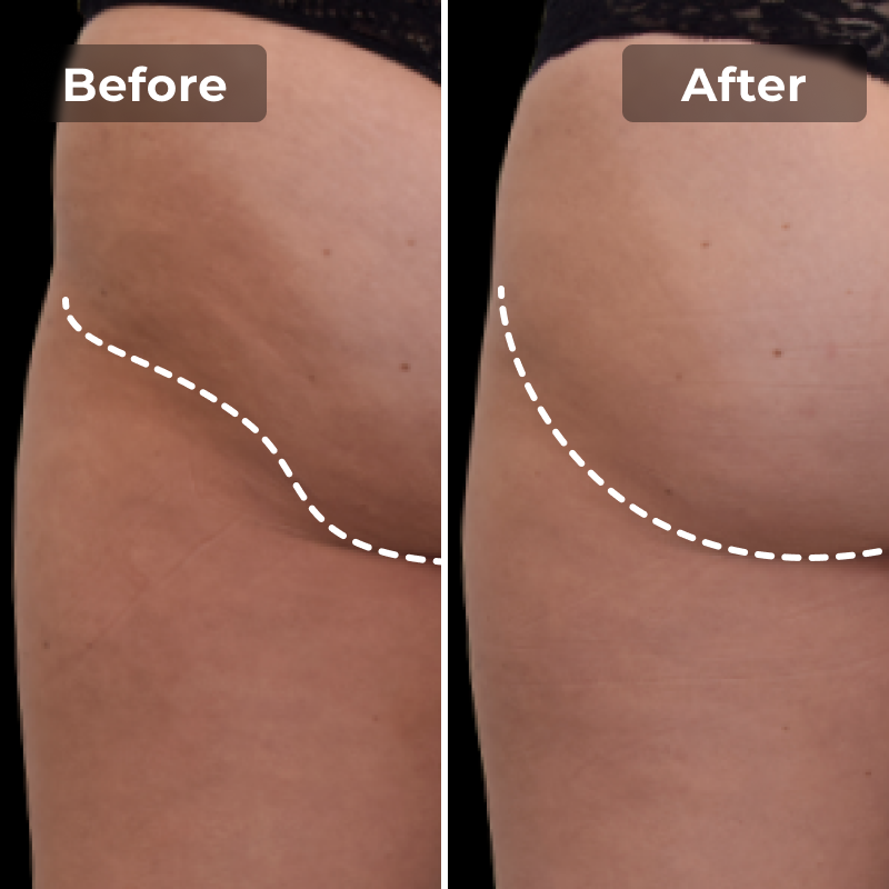 CoreLift EMS Toning Shorts