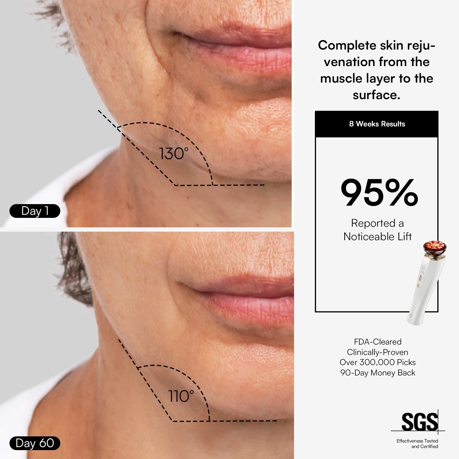 DermaCurrent Anti-Aging Therapy Wand