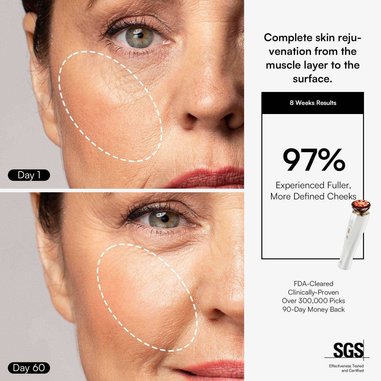 DermaCurrent Anti-Aging Therapy Wand