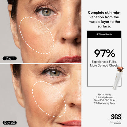 DermaCurrent Anti-Aging Therapy Wand