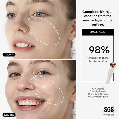 DermaCurrent Anti-Aging Therapy Wand