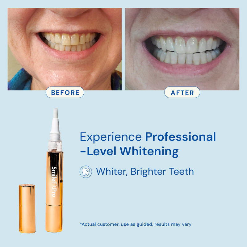 BrightSmile Whitening Pen