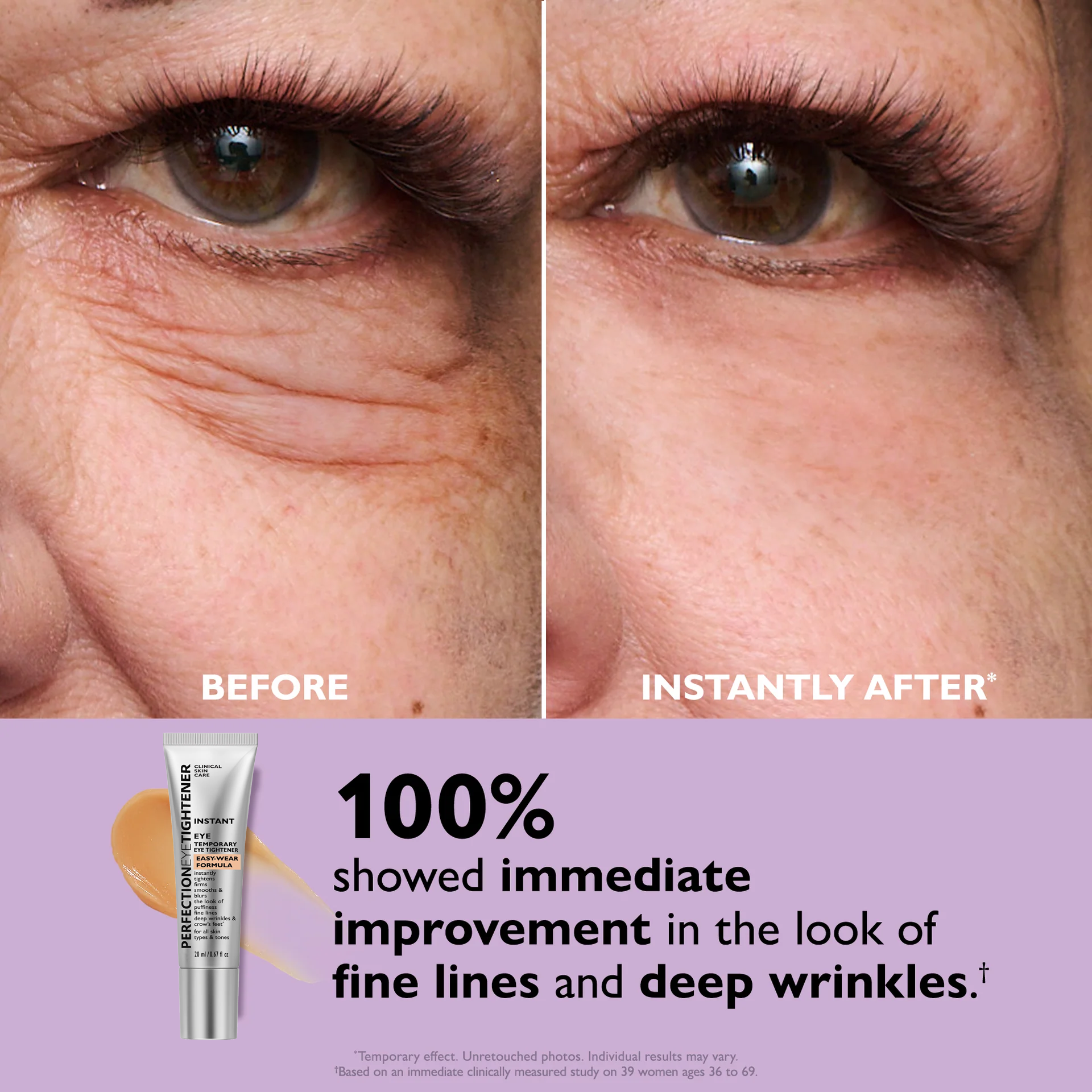 Instant Eye Tightening Cream | Buy 1 Get 1 FREE