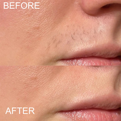 Facial Hair Remover