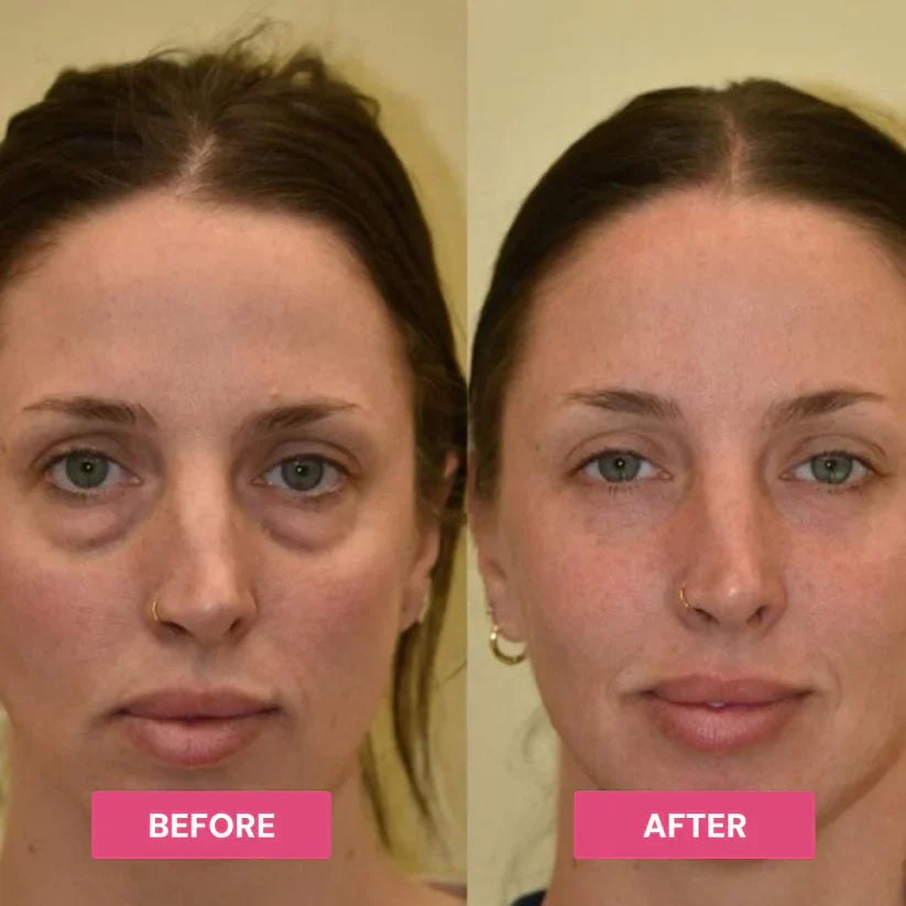 Hydrating Eye Balm