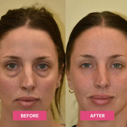 Hydrating Eye Balm