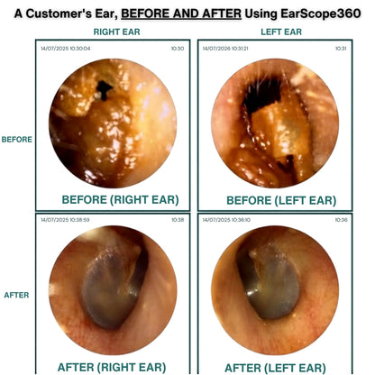 EarScope360 — Smart Ear Cleaning with HD Camera + 360° Precision Tip!