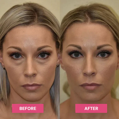 Hydrating Eye Balm