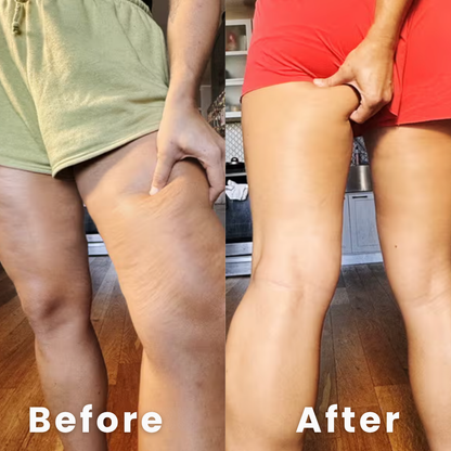 BumpAway Anti-Cellulite Massager