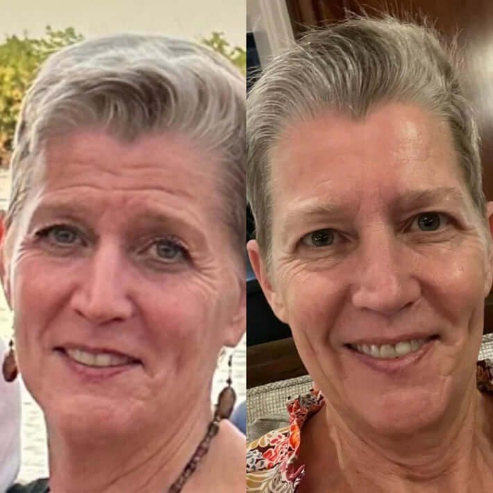 Reusable Anti-Wrinkle Sleep Patches