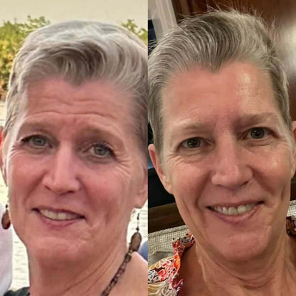 Reusable Anti-Wrinkle Sleep Patches