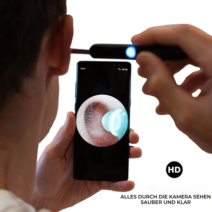 EarScope360