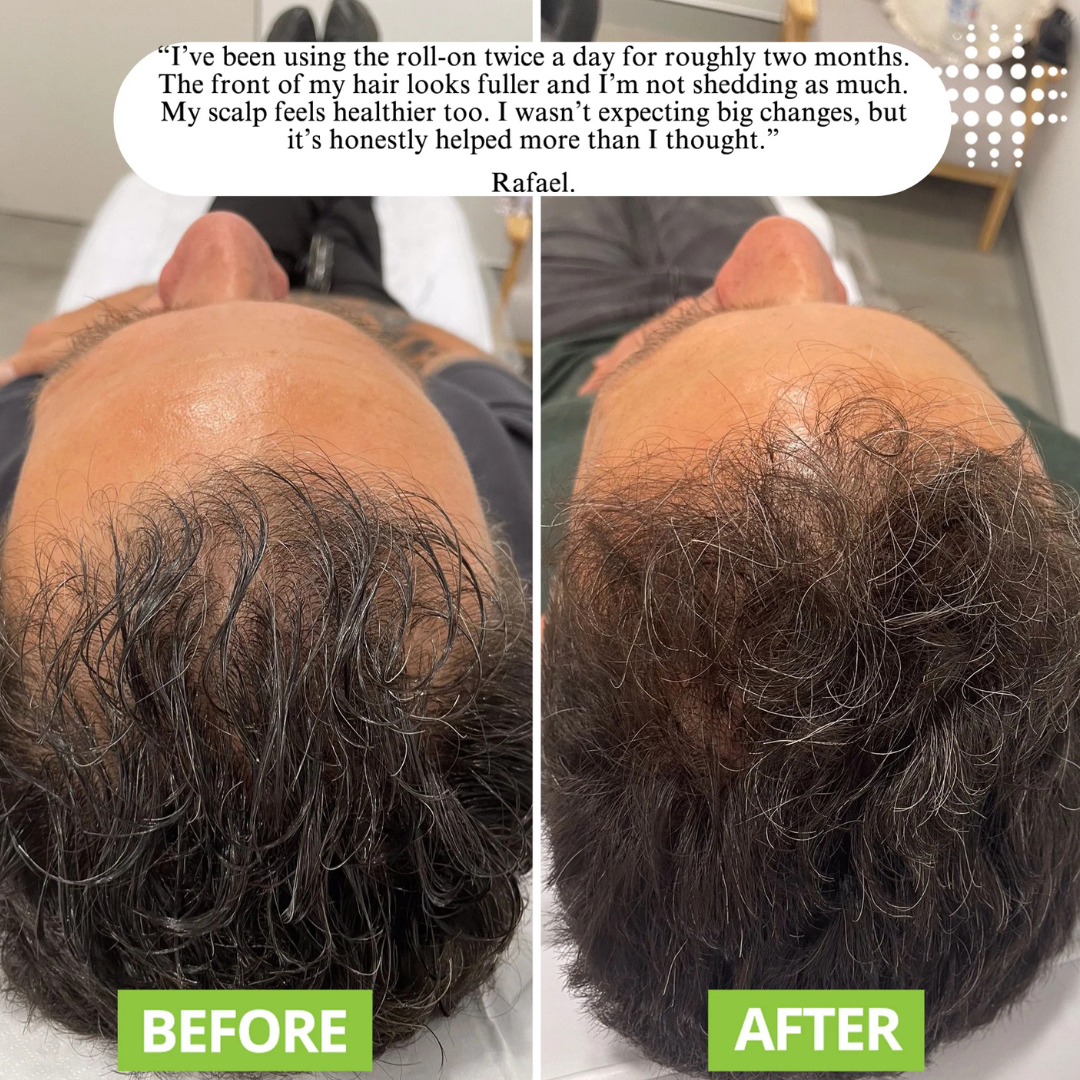 FollicleRevive Roll-On Serum