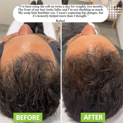 FollicleRevive Roll-On Serum