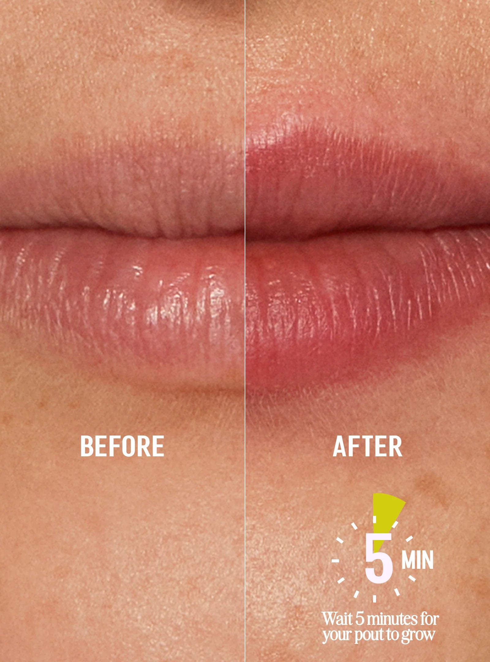 PoutLift Invisible Liner