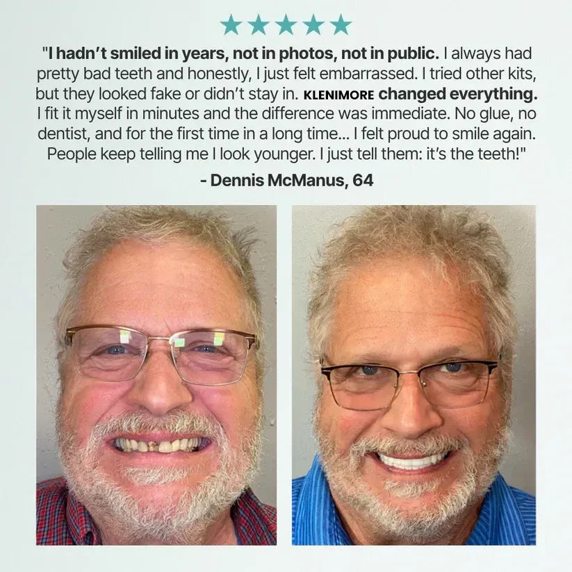 SecureSeal Functional Dentures | BUY 1 GET 1 FREE!