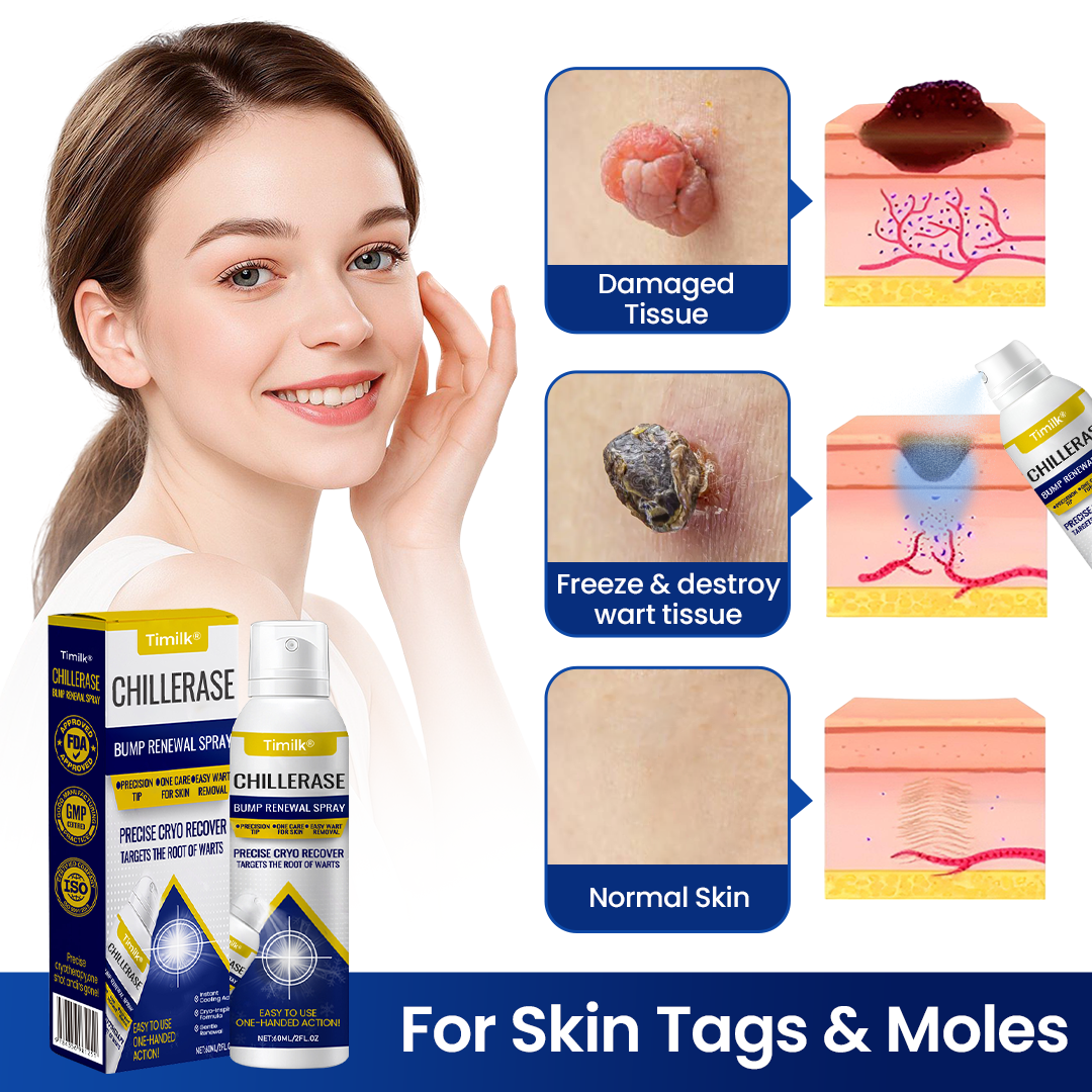 FrostMist™ — Chill Away Bumps and Unleash Silky, Touchable Skin Fast