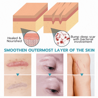 Reusable Anti-Wrinkle Sleep Patches
