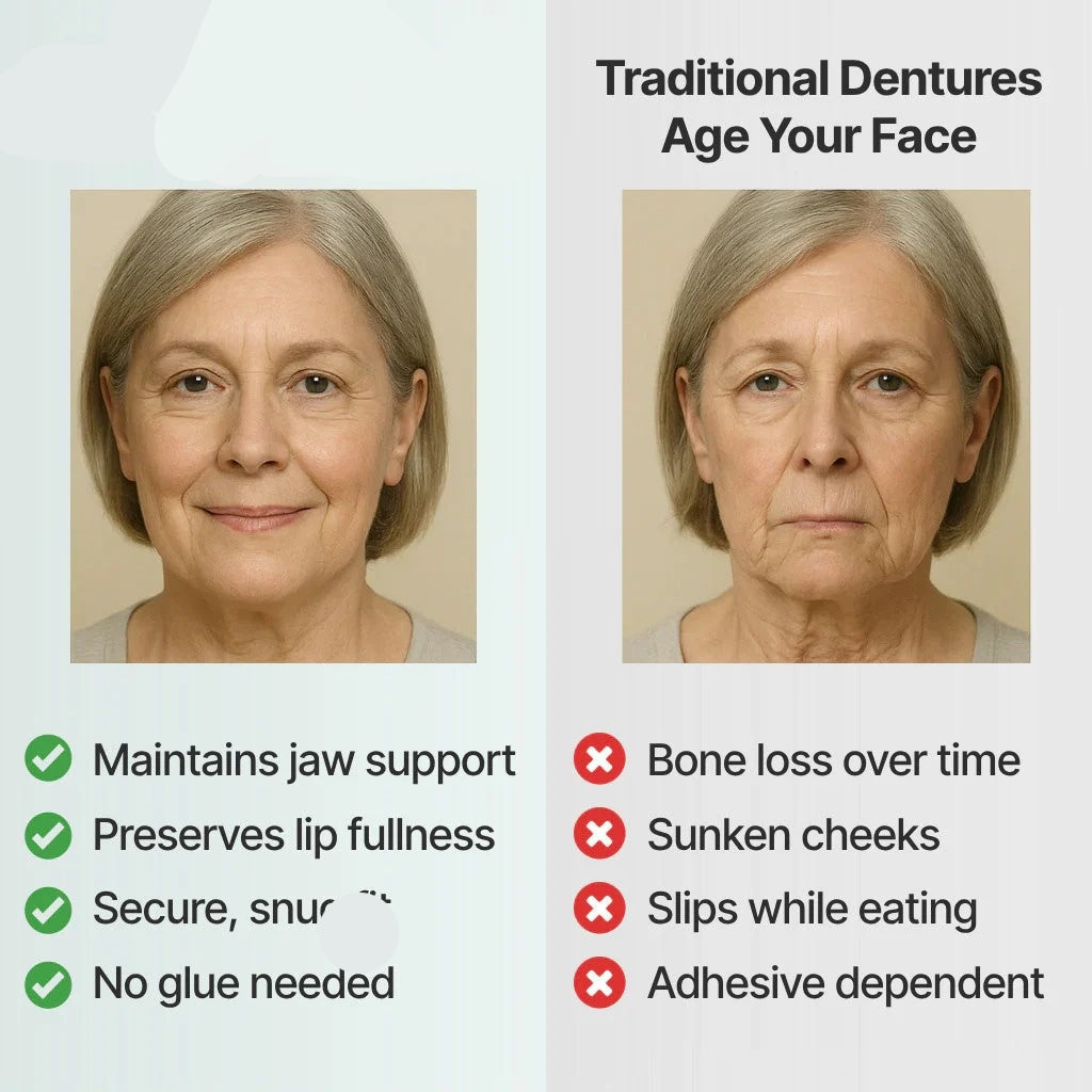 SecureSeal Functional Dentures | BUY 1 GET 1 FREE!