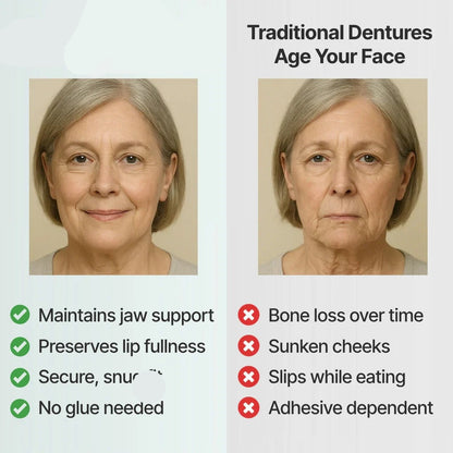 SecureSeal Functional Dentures | BUY 1 GET 1 FREE!
