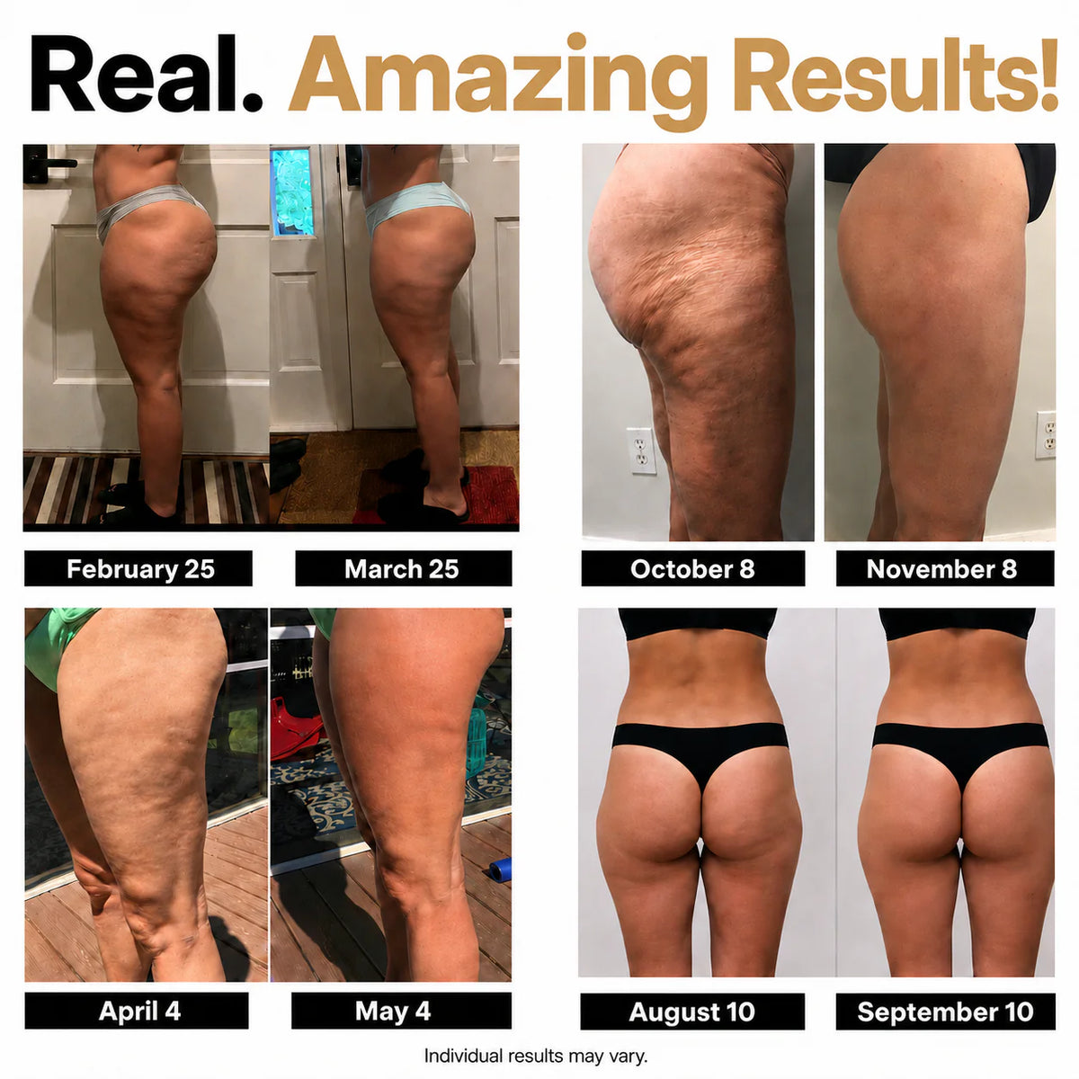 Anti-Cellulite Leggings