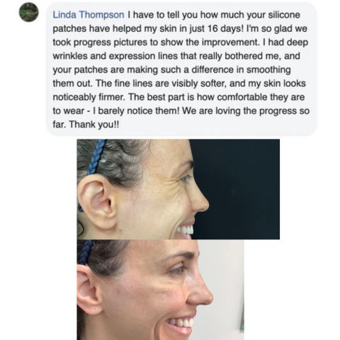 Reusable Anti-Wrinkle Sleep Patches