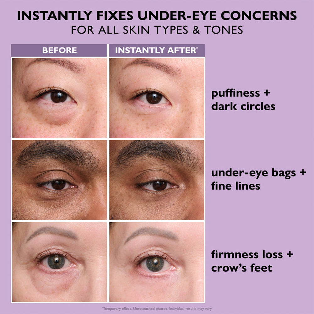 Instant Eye Tightening Cream | Buy 1 Get 1 FREE