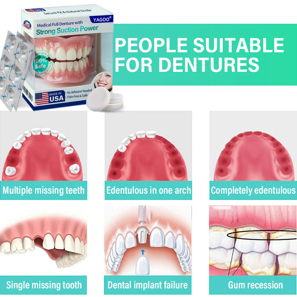 Secure Smile Denture