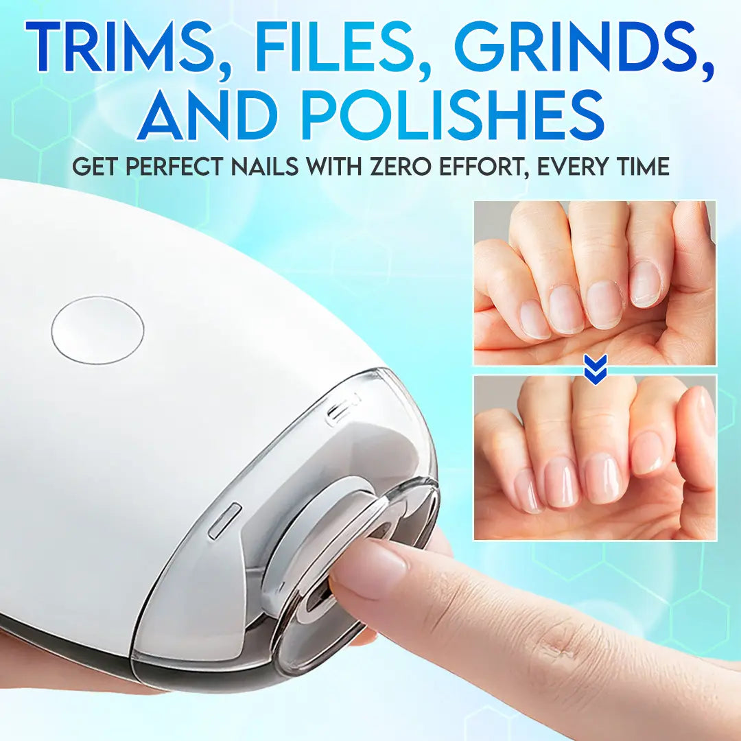 AutoNail 360 Smart Trimmer