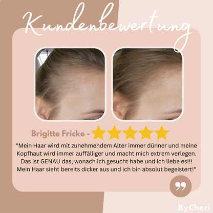 ShadeBoost Hairline Corrector
