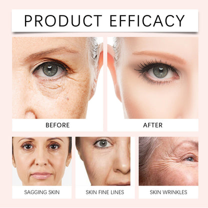 Vitamin C Anti-Wrinkle Cream