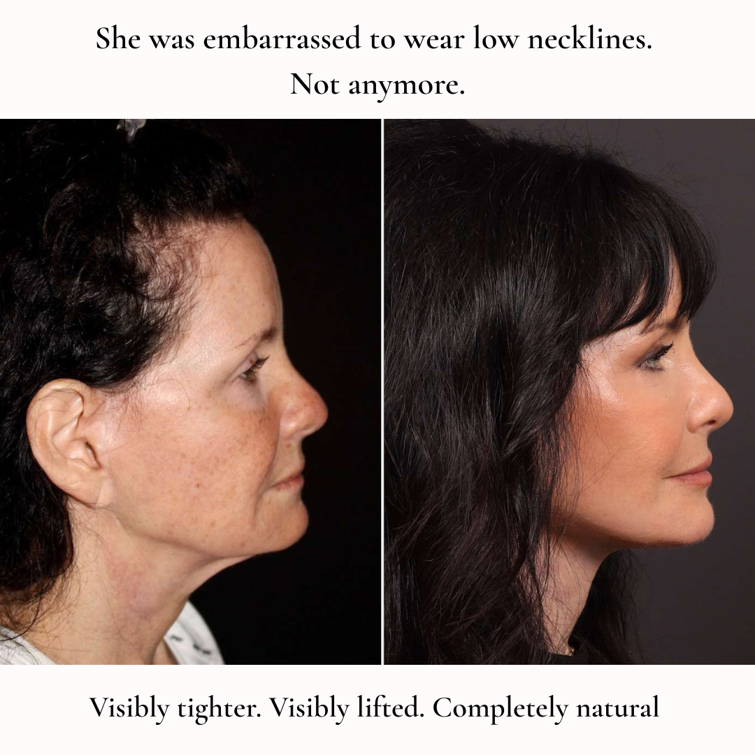 Face Sculptor for Jawline
