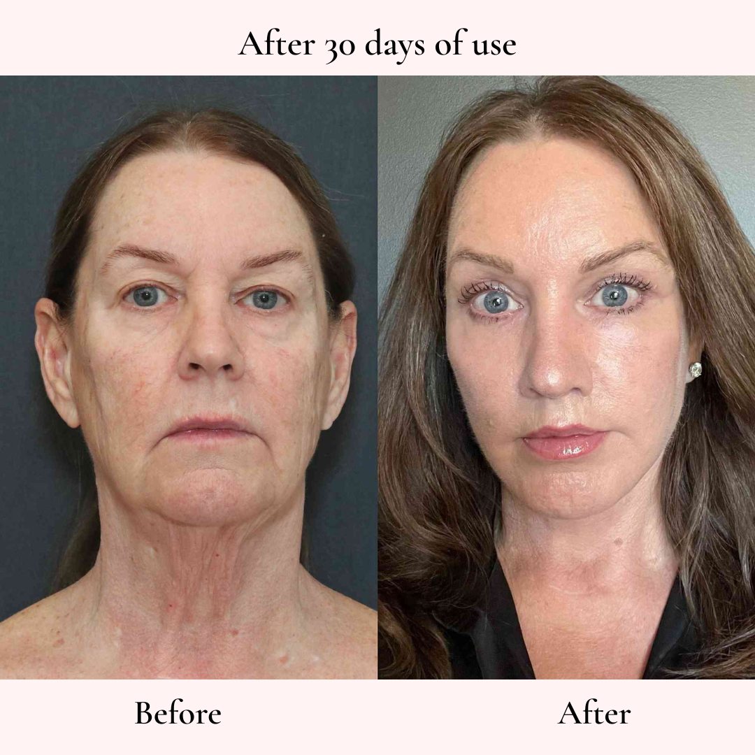 Face Sculptor for Jawline