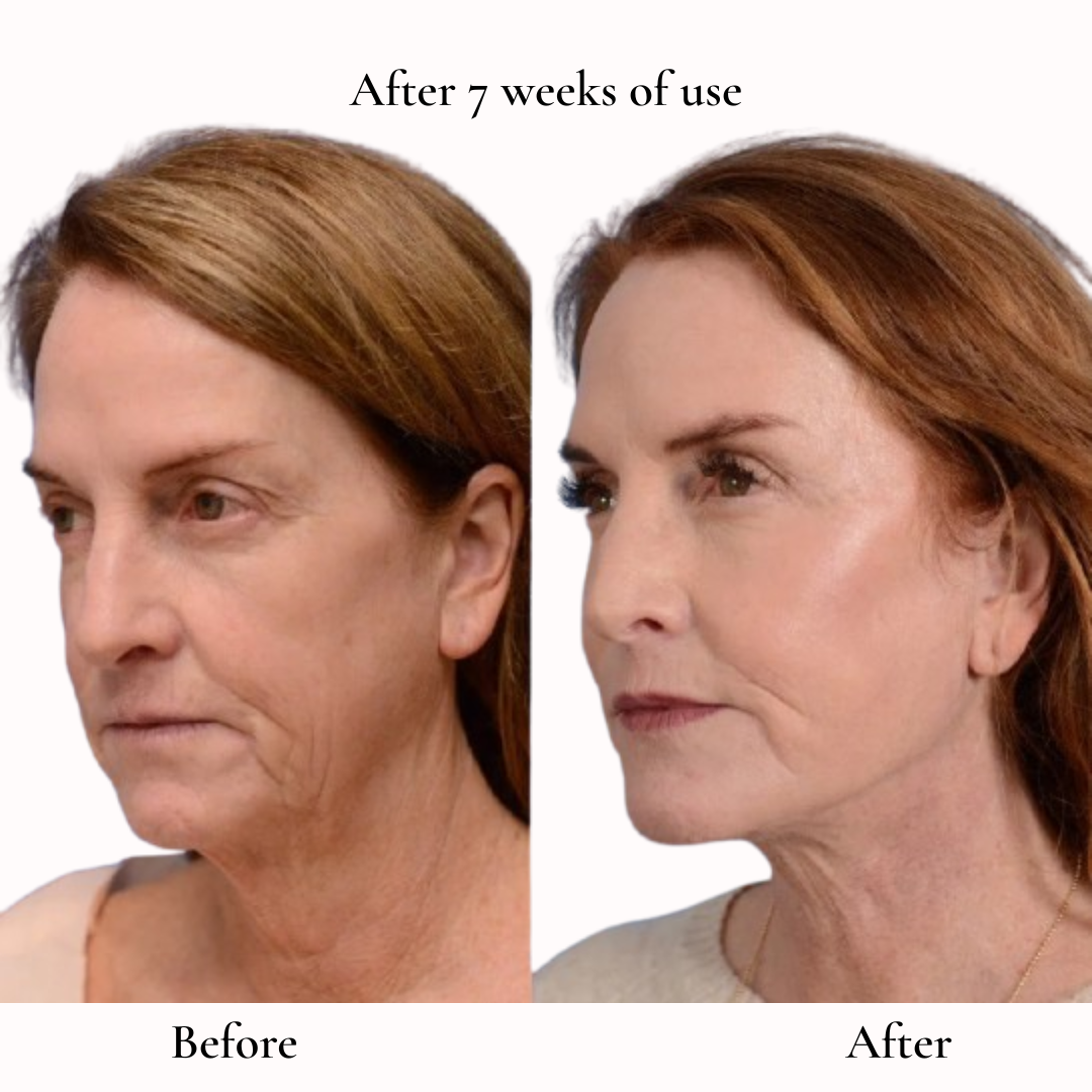 Face Sculptor for Jawline