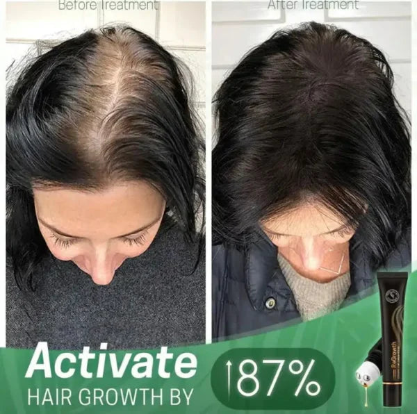 ReGrowth Organic Serum Roller - Buy 1, Get 2 Free!🔥