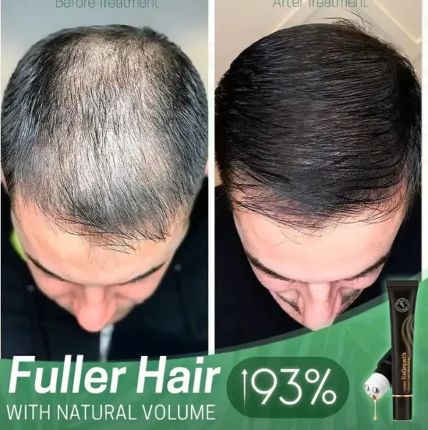 ReGrowth Organic Serum Roller - Buy 1, Get 2 Free!🔥