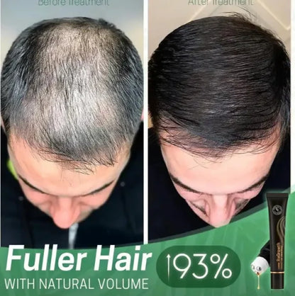 ReGrowth Organic Serum Roller - Buy 1, Get 2 Free!🔥