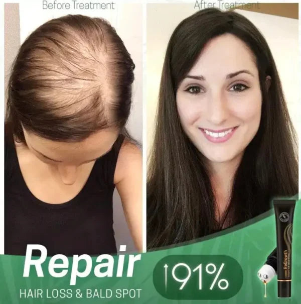 ReGrowth Organic Serum Roller - Buy 1, Get 2 Free!🔥