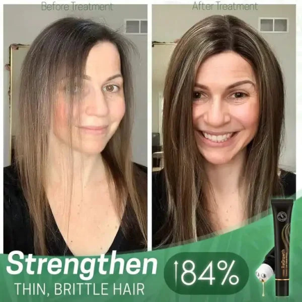 ReGrowth Organic Serum Roller - Buy 1, Get 2 Free!🔥