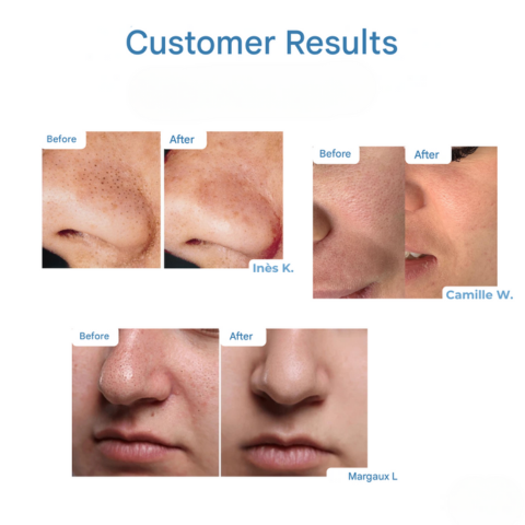 FreshDew Serum
