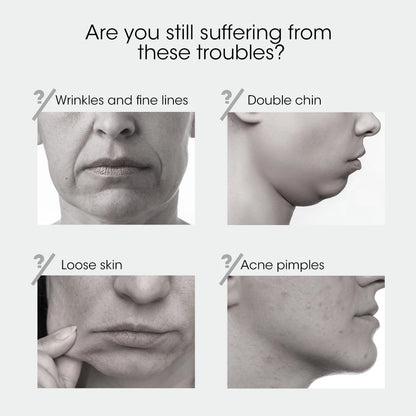 SkinRenew Jawline V-Lift