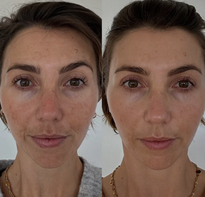 SkinRenew Pro
