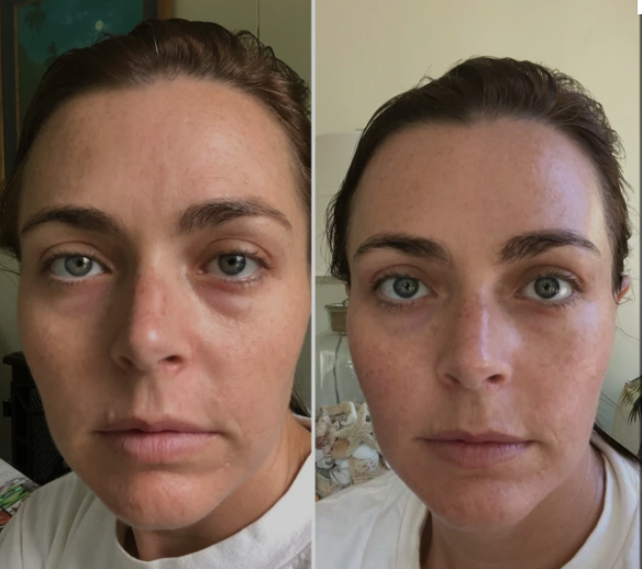 SkinRenew Pro