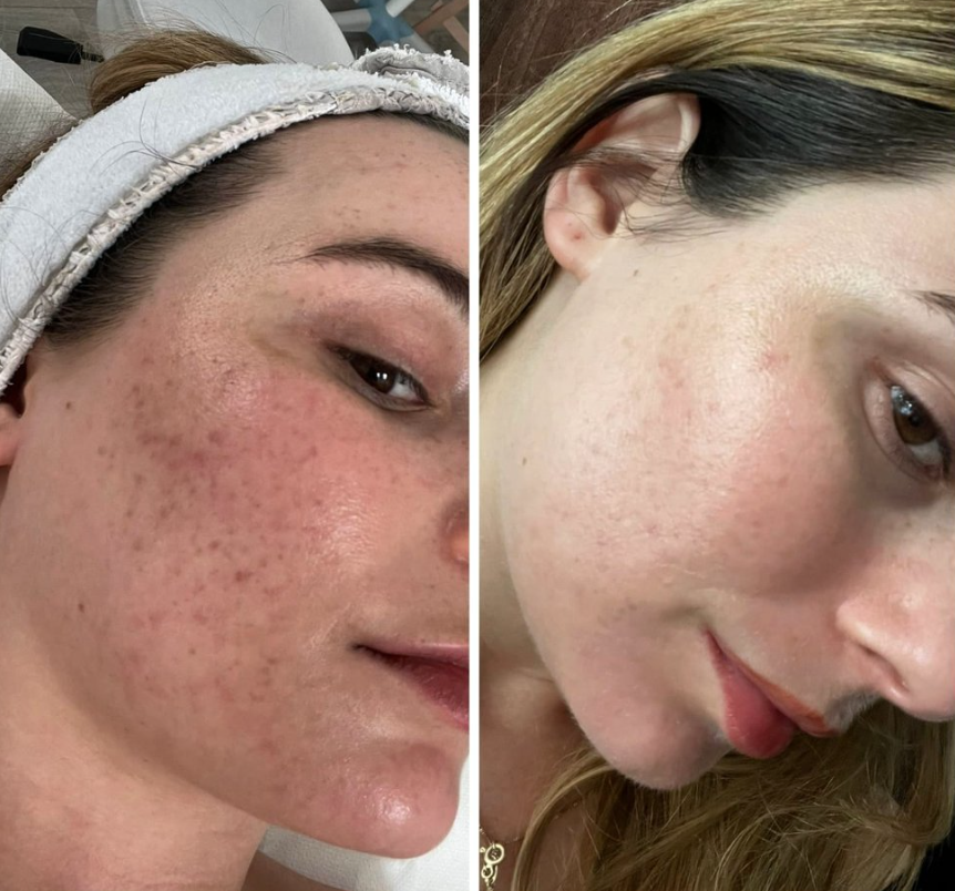 SkinRenew Pro