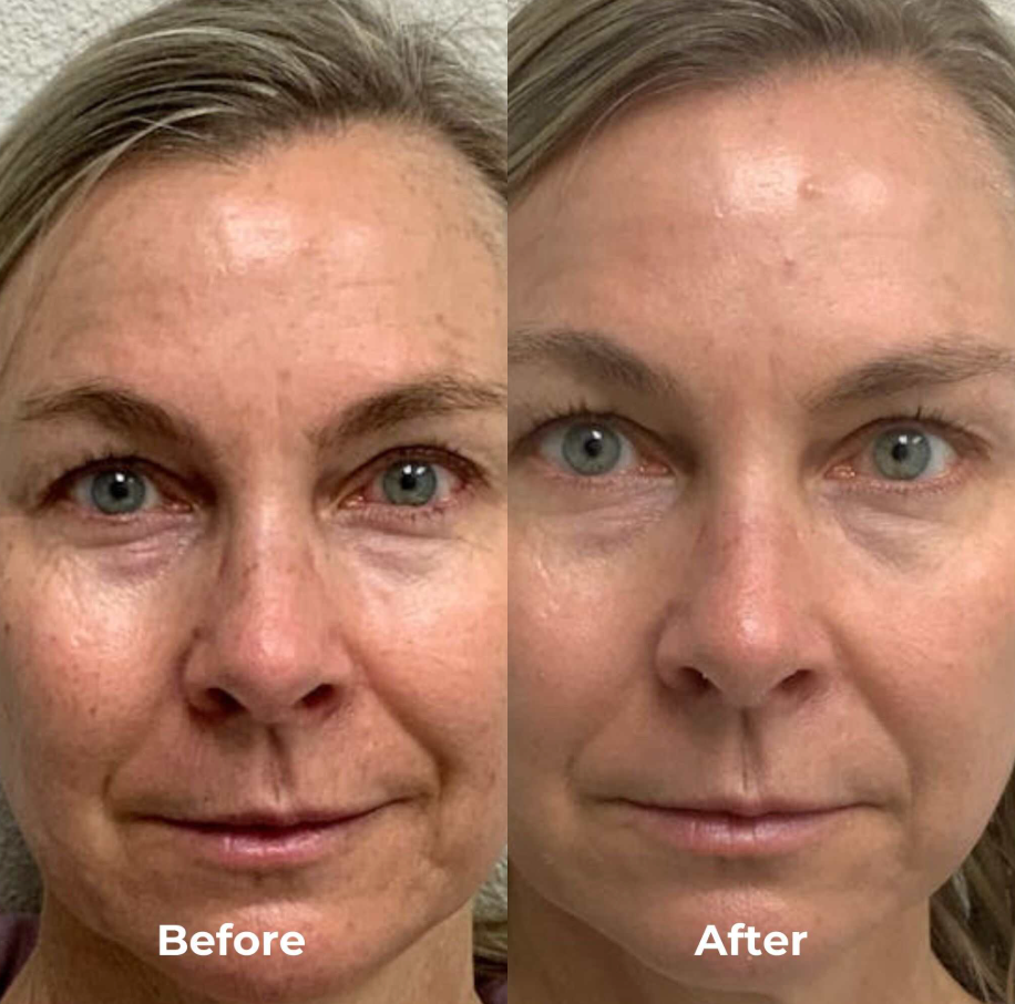 SkinRenew Pro