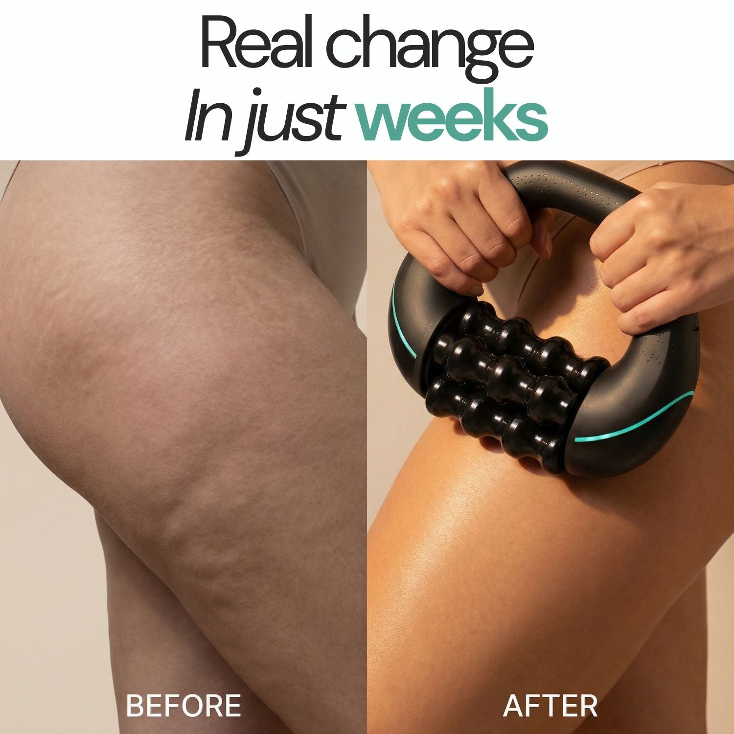 Cellulite Reduction Rollshaper