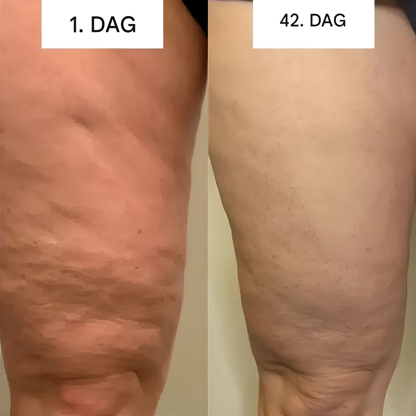GlowCup Skin Toner & Cellulite Reducer