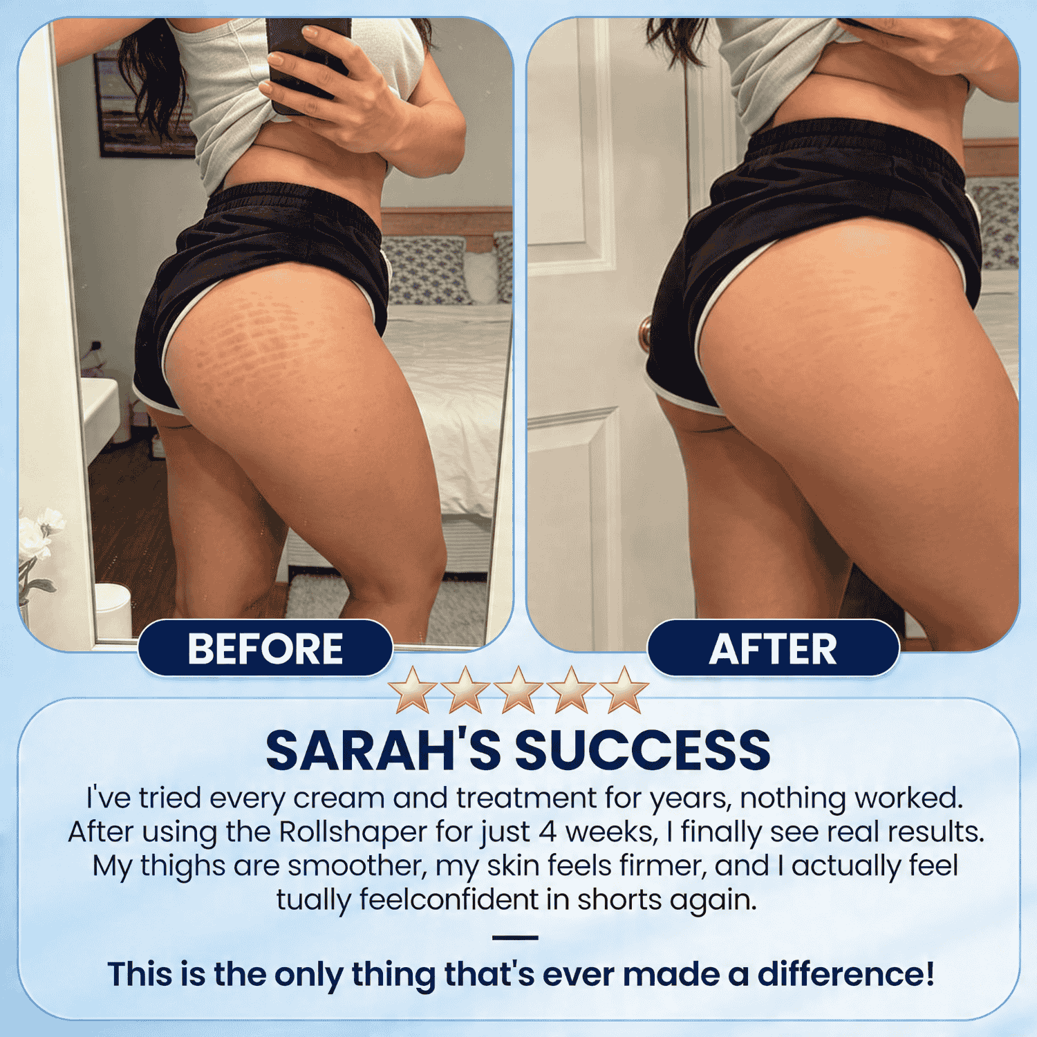Cellulite Reduction Rollshaper